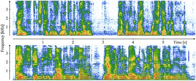 Is Speech the New Blood? Recent Progress in AI-Based Disease Detection From Audio in a Nutshell